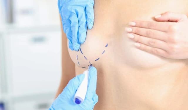 Nipple Inversion Correction