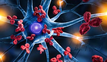 CAR-T Cell Therapy