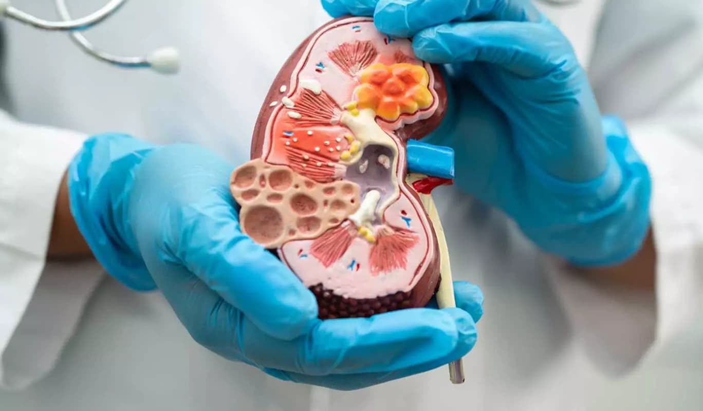 Organ Transplant