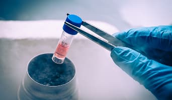 Stem Cell Therapy